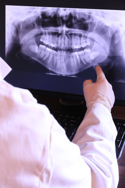 Best Emergency Wisdom Teeth Removal in Chuluota, FL